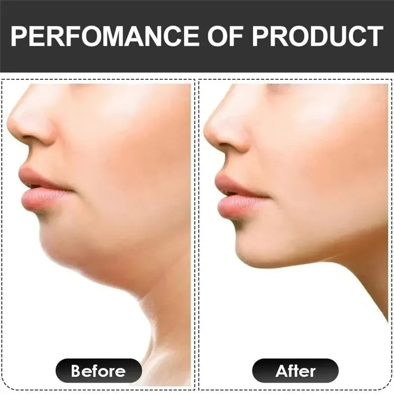 U-Shape Jaw Exerciser – Sculpt & Strengthen Your Jawline - Ravar