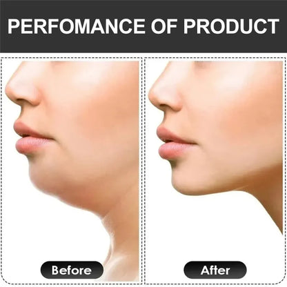 U-Shape Jaw Exerciser – Sculpt & Strengthen Your Jawline - Ravar