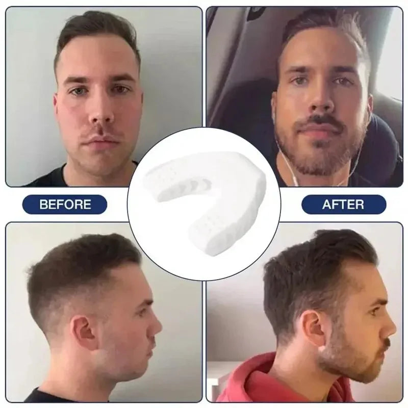 U-Shape Jaw Exerciser – Sculpt & Strengthen Your Jawline - Ravar